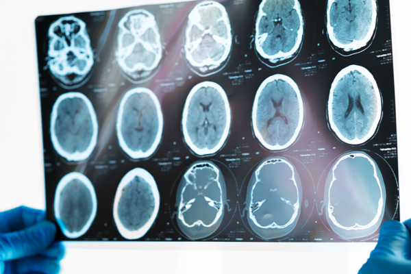 Medical Data